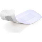 Cosmopor E eilandpleister/wondverband steriel 10 x 6 cm 25 stuks