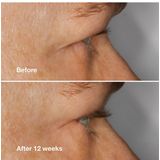 Clinique - High Impact™ Lash Amplifying Serum Wimperserum 3 ml