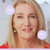 Agefit - Anti-Wrinkle Serum - 1 stuk