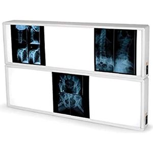 GIMA 76 x 122 cm voor radiografieplaten. TL-lamp.