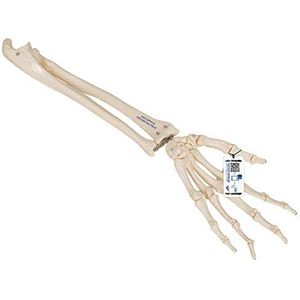 3B Scientific menselijke anatomie - handskelet met onderarm, elastisch gemonteerd - 3B Smart Anatomy