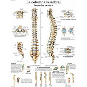 3B Scientific VR3152L educatieve poster van de menselijke anatomie - de menselijke wervelkolom, anatomie en pathologie