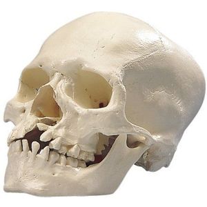 3B Scientific menselijke anatomie - microcephales schedel model