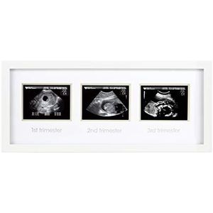 Pearhead Triple Sonogram Zwangerschap Frame, Baby Scan fotolijst, Zwangerschap Aankondiging, Wit