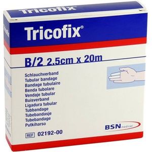 Tricofix buisverband 2,5cm x 20m maat B