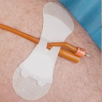 Grip-Lok latexvrije fixatiepleister Large (6-13mm) 10 stuks