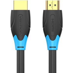 Vention HDMI Cable 3m (Black) with AACBI Technology