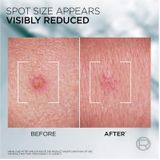 L'Oreal Men Expert - Derma Control Routine Bundle - Gezichtsverzorging - 3 Stuks