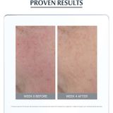 Eucerin - AntiREDNESS Concealing Day Care - Dagcrème - Groen - SPF 25