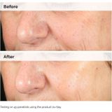 The Ordinary Alpha Arbutin 2% + HA