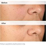 The Ordinary Alpha Arbutin 2% + HA