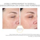 NeoStrata Enlighten Pigment Controller Crème tegen PIgmentvlekken (verhelderend) 50 ml