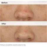 The Ordinary - Balancing & Clarifying Serum - 30ml