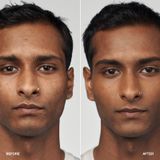 Clinique Even Better Clinical Serum Foundation SPF 20 WN 115.5 Mocha (30 ml)