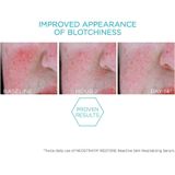 NeoStrata - Restore Redness Neutralizing Serum - Kalmerend Serum - 29 gr