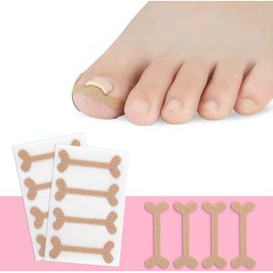 10 Sets Rolled Nail Correction Tape Toe Nail Groove Tape (One size-4 stickers / sheet)