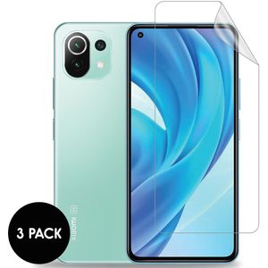 iMoshion Screenprotector Folie 3 pack voor de Xiaomi Mi 11 Lite (5G/4G) / 11 Lite 5G NE