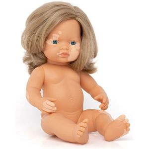 Miniland Caucasian Dark Blonde Girl With Vitiligo 38 Cm Pop