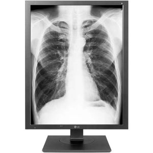 Lg Medical Diagnostic 3mp Monitor 60hz