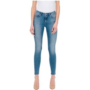 Only Blush Mid Skinny Ankle Raw Jeans Blauw M / 34 Vrouw