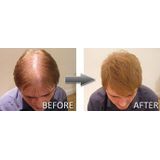 Haarstyling - Thickening Spray & Root Concealer - 200ml - Verkrijgbaar in 12 Kleuren