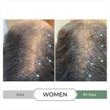 DS Laboratories - Revita.CBD Shampoo - 205 ml - Anti-haaruitval Set - Inclusief Conditioner en Lotion