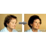 Mane - Haarverdikkende Spray - Lichtblond - 200 ml