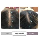 DS Laboratories - Spectral CSF - Haargroeimiddel - Voor Vrouwen - Stimuleert Haargroei