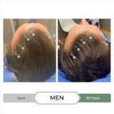 DS Laboratories - Revita.CBD Shampoo & Conditioner Pack - 250ml - 250ml