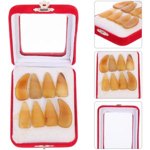 1 Set Guzheng Nagels Professionele Nail Covers Guzheng Gebruik Vinger Beschermers