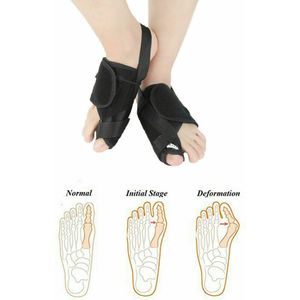 Voetverzorging Bunion Spalk Grote Teen Straightener Corrector Foot Pain Relief Hallux Valgus Orthopedische Levert Pedicure