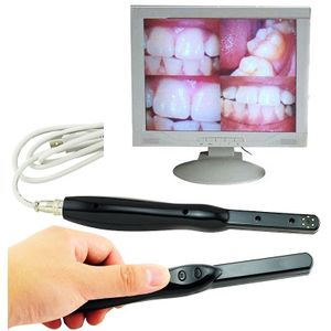 Orthodontische Beugels Oral Care Dental HD USB 2.0 Intra Orale Camera 6 Megapixels 6-LED Helder Beeld