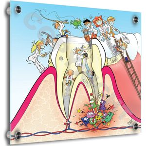 Tandarts Cartoon op plexiglas - Uniek ontwerp - Roland Hols - Doorsnede Kies - 40 x 40 cm - 5 mm dik - inclusief 4 afstandhouders chroom (zilverkleurig) - Decoratie - Orthodontist - Mondhygiënist