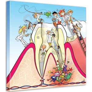 Tandarts Cartoon op canvas - Roland Hols - Doorsnede kies - 90 x 90 cm - Houten frame 4 cm dik - Orthodontist - Mondhygiënist