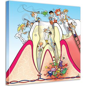Tandarts Cartoon op canvas - Roland Hols - Doorsnede kies - 60 x 60 cm - Houten frame 4 cm dik - Orthodontist - Mondhygiënist