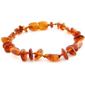 Wild Sun Barnsteen Armband Baby / Peuter - Amber Enkelbandje - Baltische Barnsteen – Pijnstillend bij Doorkomende Tanden - 14 cm - Mix - Cognac