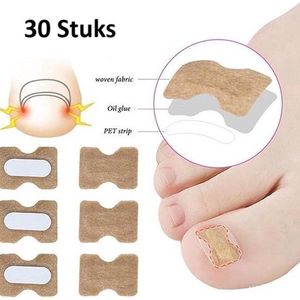 Set Van 30 Teennagel Lifters I Corrigeert Ingegroeide Teennagels I Teennagel Pleister I Anti Ingroei Pleister I Nagel Correctie Kit