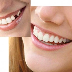 Tand afgebroken reparatie kit InstantSmile gebit (goedkope kunstgebit) - Multi shade