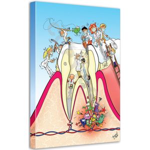 Tandarts Cartoon op canvas - Roland Hols - Doorsnede kies - 120 x 90 cm - Houten frame 4 cm dik - Orthodontist - Mondhygiënist