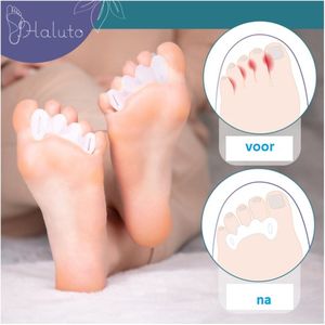 Gel separator overlays corrigeren hallux valgus en overlappende tenen - Ideaal voor gebruik bij hallux valgus en hamerteenproblemen. Ze worden over drie tenen gedragen en bieden comfortabel dragen en ondersteuning. Maat L- lengte 9 cm, breedte 2,4 cm