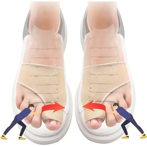 CHPN - Hallux Valgus - Tenen beschermen - Teencorrector - Knobbel - Corrigeer en zet je tenen recht met deze teenspreiders - 1 paar - Teenspreider