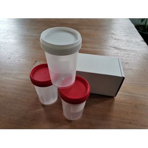 Urine Potje met Garantie Sluiting Deksel, 3 stuks. Praktische maat Urinepotje met stevige deksel. Deksel is voorzien van Garantie Sluiting. Voor urine onderzoek. Lekvrije urinebeker 170 ml. Merk: Curinda