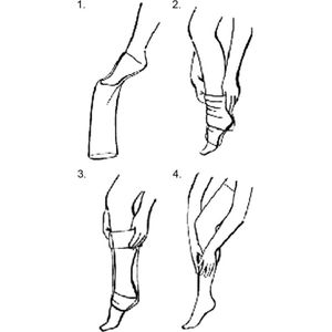 Steunpanty - compressiepanty met open teen - panty voor benen met spataderen - 280 den - zwart L/XL