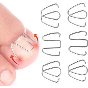 Titel: Gereedschap voor Ingegroeide Teennagel en Bunion Correctie - Pedicure en Voetverzorging