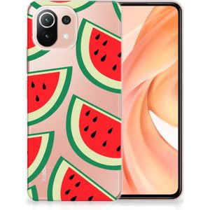 Xiaomi Mi 11 Lite | 11 Lite 5G NE Siliconen Case Watermelons