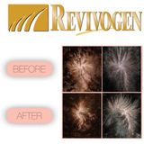 Revivogen - Scalp Therapy MD - Haargroeimiddel - 3 flessen van 60 ml - 3 maanden