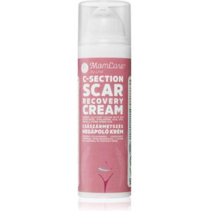 MomCare by Lina - Recovery Cream - Littekencrème - 50 ml - Lichaamsverzorging