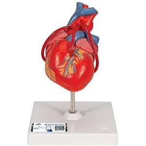 3B Scientific G05 klassiek hart met overbrugging, 2-delig + gratis anatomie software - 3B Smart Anatomy