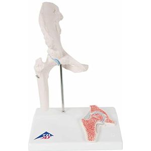 3B Scientific A84/1 mini-heupgewricht met dwarssnit, op basis + gratis anatomie-app - 3B Smart Anatomy