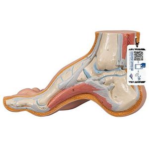 3B Scientific M32 holle voet, Pes Cavus + gratis anatomie-software - 3B Smart Anatomy